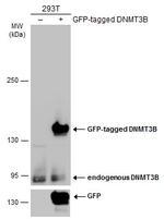 DNMT3B Antibody in Western Blot (WB)