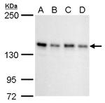 SIN3A Antibody in Western Blot (WB)