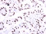 TCF2 Antibody in Immunohistochemistry (Paraffin) (IHC (P))