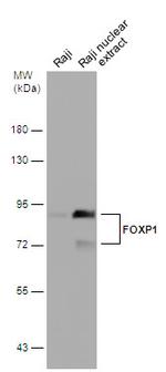 FOXP1 Antibody in Western Blot (WB)