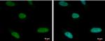 ARID1A Antibody in Immunocytochemistry (ICC/IF)