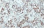 ARID1A Antibody in Immunohistochemistry (Paraffin) (IHC (P))