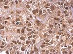 ARID1A Antibody in Immunohistochemistry (Paraffin) (IHC (P))