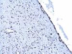 ARID1A Antibody in Immunohistochemistry (Paraffin) (IHC (P))