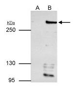 ARID1A Antibody in Immunoprecipitation (IP)