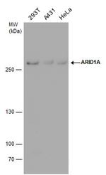 ARID1A Antibody in Western Blot (WB)