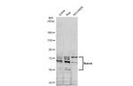 IKAROS Antibody in Western Blot (WB)