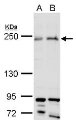 ARID2 Antibody in Western Blot (WB)