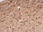 TLX3 Antibody in Immunohistochemistry (Paraffin) (IHC (P))