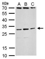 TLX3 Antibody in Western Blot (WB)