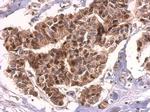 HMGB2 Antibody in Immunohistochemistry (Paraffin) (IHC (P))