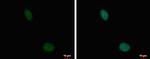 TRRAP Antibody in Immunocytochemistry (ICC/IF)