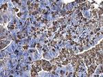 S100A9 Antibody in Immunohistochemistry (Paraffin) (IHC (P))