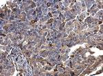 S100A9 Antibody in Immunohistochemistry (Paraffin) (IHC (P))