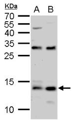 S100A9 Antibody in Western Blot (WB)