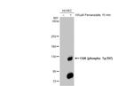 Phospho-FAK (Tyr397) Antibody in Western Blot (WB)