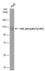 Phospho-FAK (Tyr397) Antibody in Western Blot (WB)