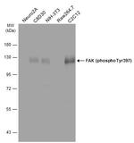 Phospho-FAK (Tyr397) Antibody in Western Blot (WB)