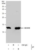 SEC61B Antibody in Immunoprecipitation (IP)