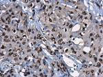 p14ARF Antibody in Immunohistochemistry (Paraffin) (IHC (P))