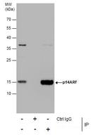 p14ARF Antibody in Immunoprecipitation (IP)