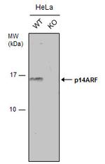 p14ARF Antibody in Western Blot (WB)