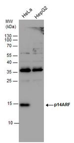 p14ARF Antibody in Western Blot (WB)