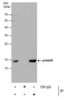 p14ARF Antibody in Immunoprecipitation (IP)