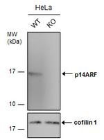 p14ARF Antibody in Western Blot (WB)