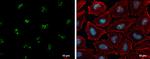 p14ARF Antibody in Immunocytochemistry (ICC/IF)