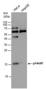 p14ARF Antibody in Western Blot (WB)