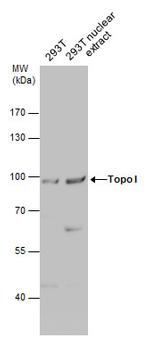 TOP1 Antibody in Western Blot (WB)