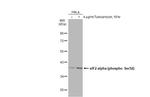 Phospho-EIF2S1 (Ser52) Antibody in Western Blot (WB)