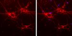 alpha Internexin Antibody in Immunocytochemistry (ICC/IF)