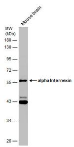 alpha Internexin Antibody in Western Blot (WB)