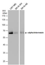 alpha Internexin Antibody in Western Blot (WB)