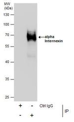 alpha Internexin Antibody in Immunoprecipitation (IP)