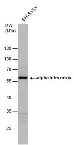 alpha Internexin Antibody in Western Blot (WB)