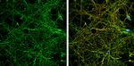 NMDAR2B Antibody in Immunocytochemistry (ICC/IF)