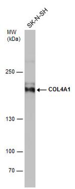 COL4A1 Antibody in Western Blot (WB)