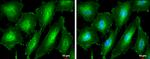 PKC alpha Antibody in Immunocytochemistry (ICC/IF)