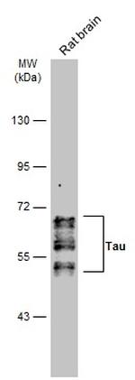 Phospho-Tau (Ser262) Antibody in Western Blot (WB)