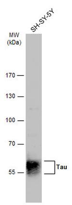 Phospho-Tau (Ser262) Antibody in Western Blot (WB)