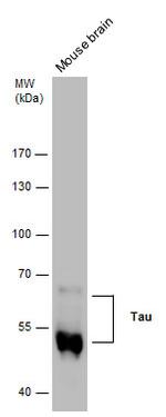 Phospho-Tau (Ser262) Antibody in Western Blot (WB)