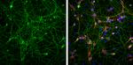 Phospho-Tau (Ser262) Antibody in Immunocytochemistry (ICC/IF)