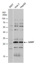 GAMT Antibody in Western Blot (WB)