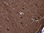 PYK2 Antibody in Immunohistochemistry (Paraffin) (IHC (P))