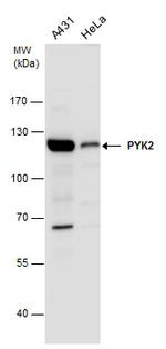 PYK2 Antibody in Western Blot (WB)