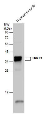 TNNT3 Antibody in Western Blot (WB)