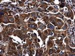 PKR Antibody in Immunohistochemistry (Paraffin) (IHC (P))